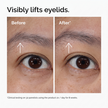 Lacto-PDRN 4% + B9 Eye Cream